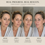 Age Reset